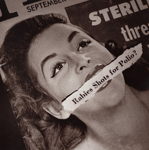 rabies shots for polio