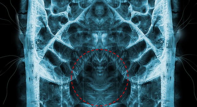 Alien/interdimensional 
NHB Anatomy MRI & X Rays