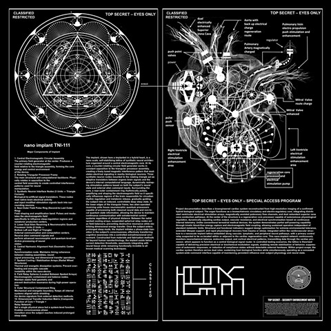 HYBRID HEART WITH TI-111 IMPLANT