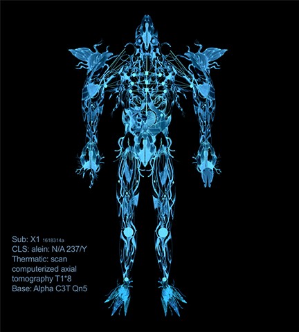 Sub: X1 1618314a CLS: alein: N/A 237/Y  Thermatic: scan computerized axial tomography T1*8 Base: Alpha C3T Qn5