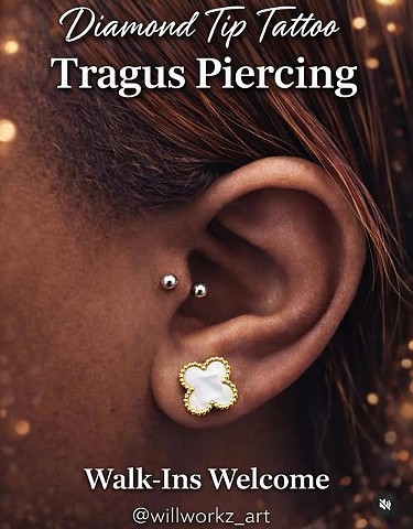 Tragus (healed)