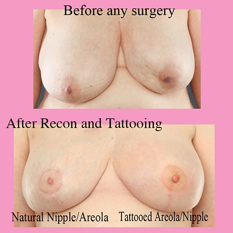 3-d unilateral nipple tattoo