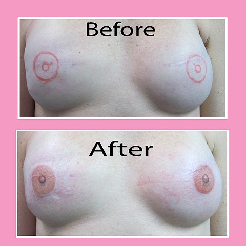 3-D nipple tattoos