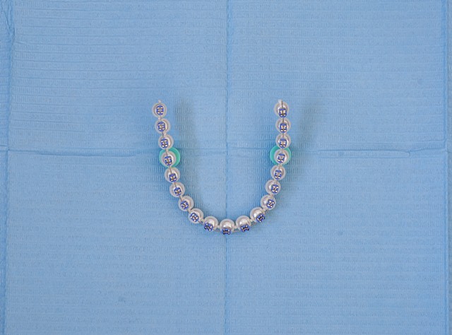 Brace Yourself Series