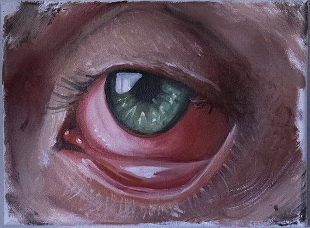  eye study