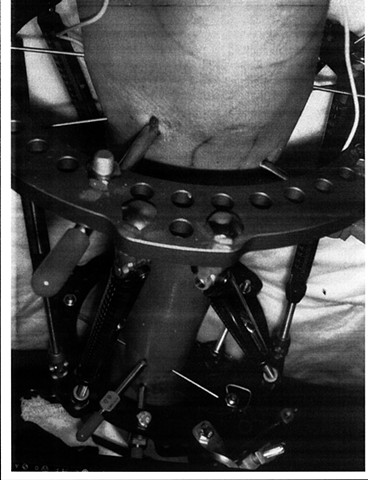 Fixator 