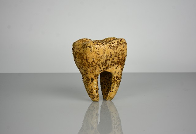 Thankfully, I Still Have Dental Insurance