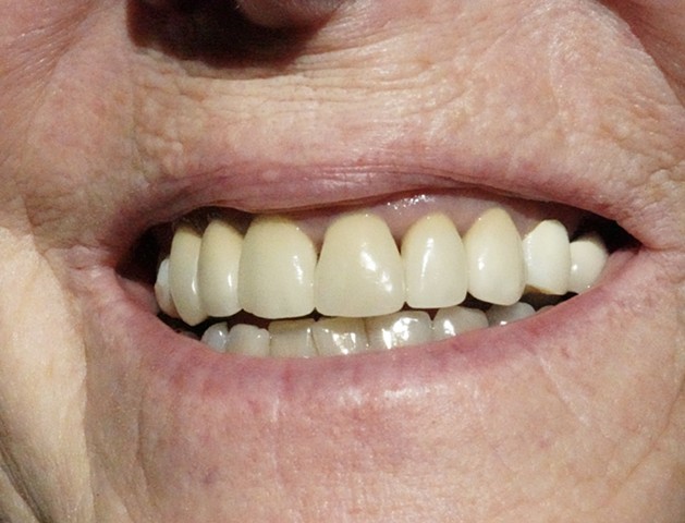 My Grandma's Teeth