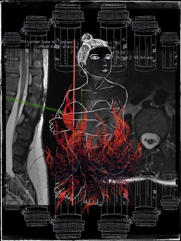 Self Portrait (Through Pain)
