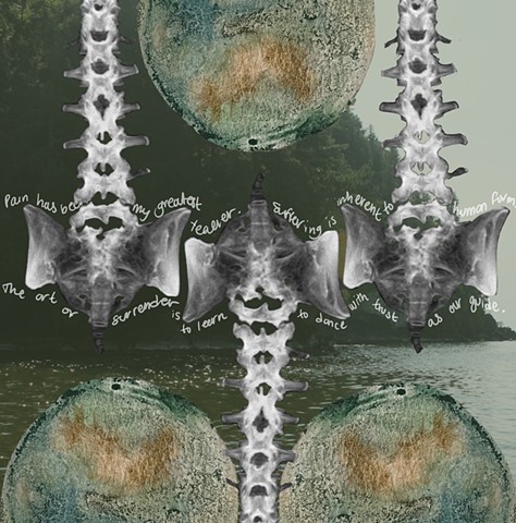 Inherent Interconnection 