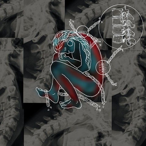 Vertebral Meditations 1/?