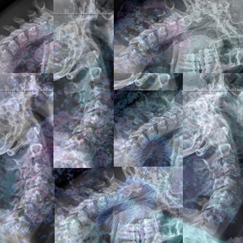 Vertebral Meditations 1/?