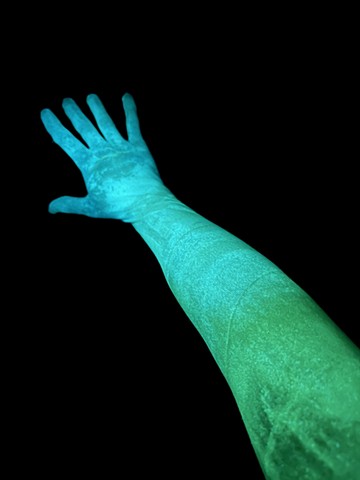 Arm 2/2