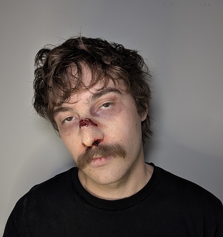 Broken Nose 