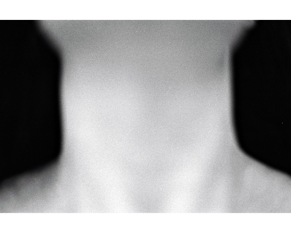 A Mouth Full of Marbles