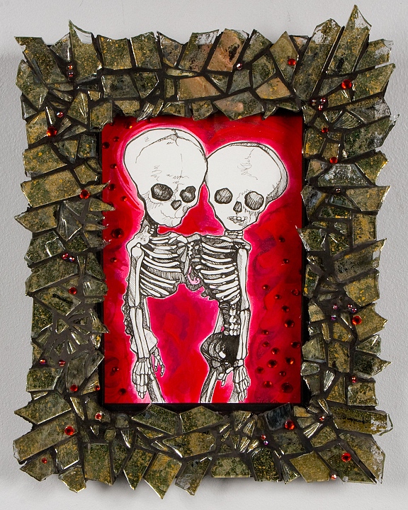 siamese fetal skeletons